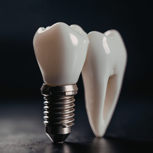 Implante dentário dói? Entenda como funciona o procedimento